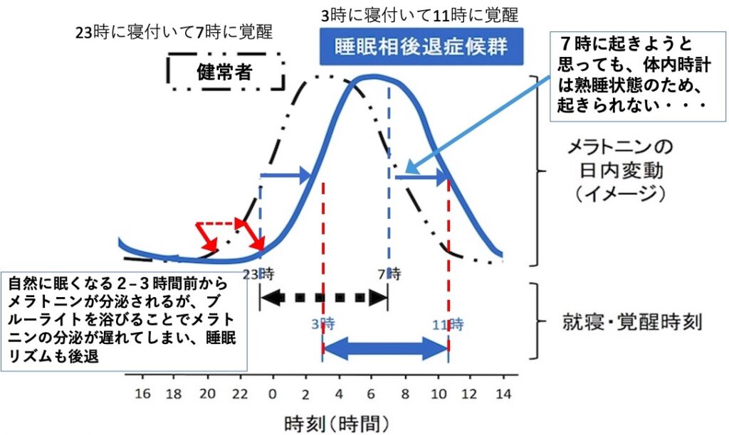 画像に alt 属性が指定されていません。ファイル名: f4fe2f4160012dd7905861e7fe4d0253-1024x612.jpg